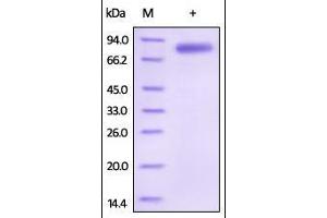 SDS-PAGE (SDS) image for Interleukin 12 beta (IL12B) (AA 23-328) protein (Fc Tag) (ABIN2181332) (IL12B Protein (AA 23-328) (Fc Tag))