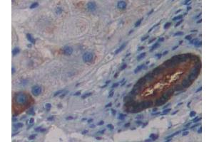DAB staining on IHC-P; Samples: Human Liver Tissue (LSR Antikörper  (AA 335-589))