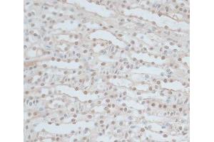 Immunohistochemistry of paraffin-embedded Mouse kidney using ZNF562 Polyclonal Antibody at dilution of 1:100 (40x lens). (ZNF562 Antikörper)