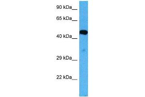 Western Blotting (WB) image for anti-Activin A Receptor, Type IIB (ACVR2B) (Middle Region) antibody (ABIN2782110)