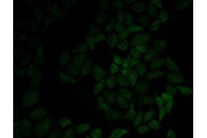 Immunofluorescence analysis of HeLa cell using MSN antibody. (Moesin Antikörper  (AA 1-300))