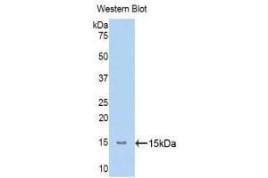 Western Blotting (WB) image for anti-Mannan-Binding Lectin serine Peptidase 2 (MASP2) (AA 170-287) antibody (ABIN1173814) (MASP2 Antikörper  (AA 170-287))