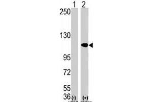 Western blot analysis of AOF2 (arrow) using AOF2 polyclonal antibody . (LSD1 Antikörper  (N-Term))
