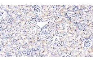 Immunohistochemistry (IHC) image for anti-Insulin-Like Growth Factor Binding Protein 2, 36kDa (IGFBP2) (AA 34-317) antibody (ABIN7430591)