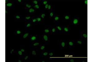 Image no. 4 for anti-Zinc Finger Protein 207 (ZNF207) (AA 1-111) antibody (ABIN599016) (ZNF207 Antikörper  (AA 1-111))