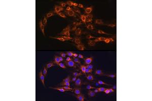 Immunofluorescence analysis of C6 cells using FCGRT Rabbit pAb (ABIN6127922, ABIN6140552, ABIN6140553 and ABIN6224639) at dilution of 1:100 (40x lens). (FcRn Antikörper  (AA 25-300))