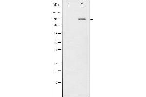 Western blot analysis of Met phosphorylation expression in HepG2 whole cell lysates,The lane on the left is treated with the antigen-specific peptide. (c-MET Antikörper  (pTyr1349))