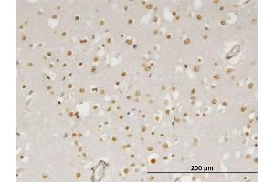 Immunoperoxidase of monoclonal antibody to ZIC4 on formalin-fixed paraffin-embedded human cerebral cortex. (ZIC4 Antikörper  (AA 1-90))