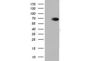 Western Blotting (WB) image for anti-Peroxisomal Biogenesis Factor 5 (PEX5) antibody (ABIN1500157) (PEX5 Antikörper)