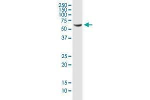 Western Blotting (WB) image for anti-PDZ and LIM Domain 5 (PDLIM5) (AA 1-596) antibody (ABIN564629)