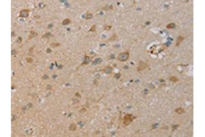 The image on the left is immunohistochemistry of paraffin-embedded Human brain tissue using ABIN7130528(PAGE2 Antibody) at dilution 1/20, on the right is treated with fusion protein. (PAGE2 Antikörper)