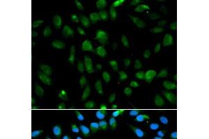 Immunofluorescence analysis of MCF-7 cells using PSMA3 Polyclonal Antibody (PSMA3 Antikörper)