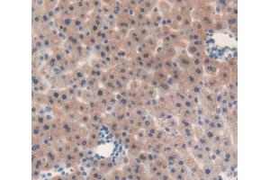 Used in DAB staining on fromalin fixed paraffin- embedded liver tissue (IL-25 Antikörper  (AA 33-169))