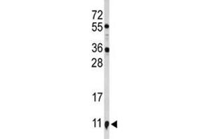 Western blot analysis of S100A10 antibody and NCI-H460 lysate. (S100A10 Antikörper  (AA 12-40))