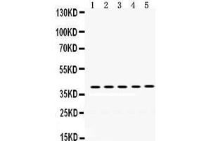 Western Blotting (WB) image for anti-Oncostatin M (OSM) (AA 26-220) antibody (ABIN3043458)