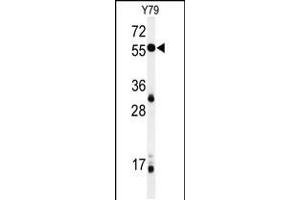 Western blot analysis of NOB1 Antibody in Y79 cell line lysates (35ug/lane) (NOB1 Antikörper  (C-Term))