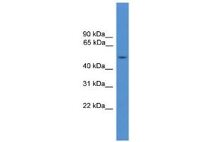 WB Suggested Anti-IL7R Antibody Titration: 0. (IL7R Antikörper  (Middle Region))