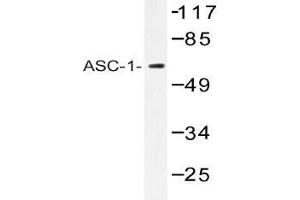 Western blot (WB) analysis of ASC-1 antibody in extracts from K562 cells.