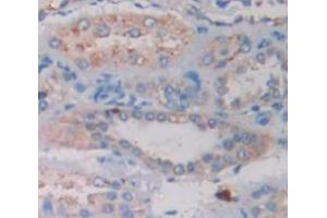 IHC-P analysis of Human Tissue, with DAB staining. (Riboflavin Kinase Antikörper  (AA 1-155))