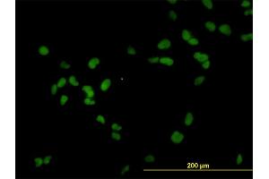 Immunofluorescence of monoclonal antibody to RCC1 on HeLa cell. (RCC1 Antikörper  (AA 312-421))