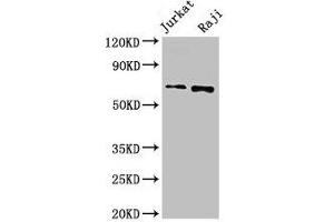 Western Blot Positive WB detected in: Jurkat whole cell lysate, Raji whole cell lysate All lanes: CDC6 antibody at 2. (CDC6 Antikörper  (AA 1-141))
