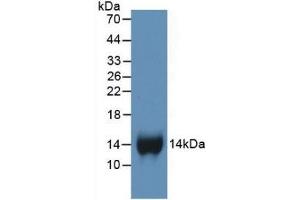 Detection of Recombinant bTG, Human using Monoclonal Antibody to Chemokine (C-X-C motif) ligand 7 ( CXCL7) (CXCL7 Antikörper  (AA 59-128))
