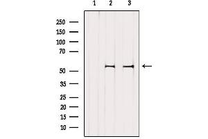 Western Blotting (WB) image for anti-V-Yes-1 Yamaguchi Sarcoma Viral Related Oncogene Homolog (LYN) (C-Term) antibody (ABIN6263031)