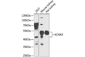 Western blot analysis of extracts of various cell lines, using KCNK9 antibody  at 1:1000 dilution. (KCNK9 Antikörper  (AA 1-100))