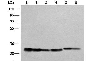 Western blot analysis of Human heart tissue A549 231 Jurkat HEPG2 and Hela cell lysates using ATP5C1 Polyclonal Antibody at dilution of 1:1000 (ATP5C1 Antikörper)