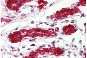 Human Breast (formalin-fixed, paraffin-embedded) stained with PDCD4 antibody ABIN364343 at 5 ug/ml followed by biotinylated anti-mouse IgG secondary antibody ABIN481714, alkaline phosphatase-streptavidin and chromogen. (PDCD4 Antikörper  (AA 1-469))