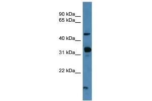 WB Suggested Anti-NPFFR2 Antibody Titration: 0. (NPFFR2 Antikörper  (C-Term))