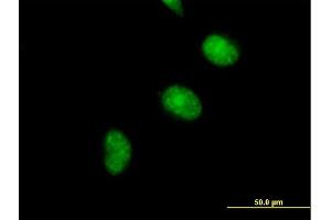 Immunofluorescence of purified MaxPab antibody to CDCA5 on HeLa cell.