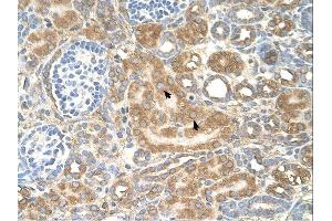 SPTLC1 antibody was used for immunohistochemistry at a concentration of 4-8 ug/ml. (SPTLC1 Antikörper  (Middle Region))