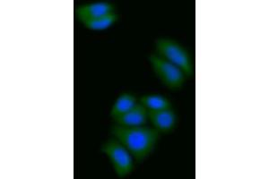 Detection of S100A6 in Human MCF7 cell using Polyclonal Antibody to S100 Calcium Binding Protein A6 (S100A6) (S100A6 Antikörper  (AA 1-90))