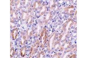 Immunohistochemistry (Paraffin-embedded Sections) (IHC (p)) image for anti-DNA Fragmentation Factor, 40kDa, beta Polypeptide (Caspase-Activated DNase) (DFFB) (C-Term) antibody (ABIN499517)