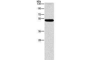 Western Blot analysis of Human lung cancer tissue using CALCRL Polyclonal Antibody at dilution of 1:550 (CALCRL Antikörper)