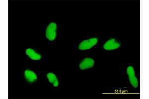 Immunofluorescence of purified MaxPab antibody to DR1 on HeLa cell. (DR1 Antikörper  (AA 1-176))