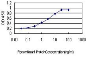 Detection limit for recombinant GST tagged PITX1 is approximately 0. (PITX1 Antikörper  (AA 225-313))