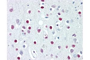 Anti-WHSC1 / NSD2 antibody IHC of human brain, cortex. (WHSC1 Antikörper  (AA 219-268))