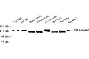 Western blot analysis of OB-Cadherin (ABIN7073255) at dilution of 1: 500 (OB Cadherin Antikörper)