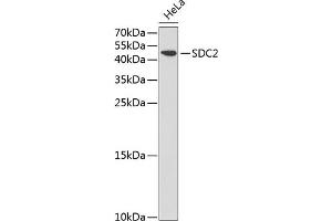 Western blot analysis of extracts of HeLa cells, using SDC2 antibody (ABIN3022587, ABIN3022588, ABIN3022589 and ABIN6218928) at 1:1000 dilution. (Syndecan 2 Antikörper  (AA 19-144))