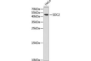Western blot analysis of extracts of HeLa cells, using SDC2 antibody (ABIN3022587, ABIN3022588, ABIN3022589 and ABIN6218928) at 1:1000 dilution. (Syndecan 2 Antikörper  (AA 19-144))
