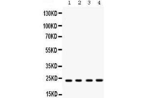 Western blot analysis of Rab9 expression in rat brain extract (lane 1), mouse brain extract (lane 2), HELA whole cell lysates (lane 3) and MCF-7 whole cell lysates (lane 4).