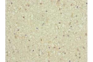 Immunohistochemistry (IHC) image for anti-Actin Related Protein 2/3 Complex, Subunit 5, 16kDa (ARPC5) (AA 1-154) antibody (ABIN7143097)
