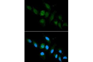 Immunofluorescence analysis of U2OS cell using HLA-A antibody. (HLA-A Antikörper  (AA 35-285))