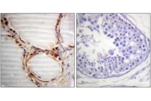 Immunohistochemistry analysis of paraffin-embedded human testis tissue, using MCM4 (Ab-54) Antibody. (MCM4 Antikörper  (AA 20-69))