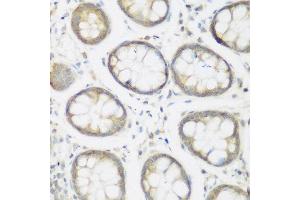 Immunohistochemistry of paraffin-embedded human colon using NFU1 antibody at dilution of 1:200 (40x lens). (NFU1 Antikörper)