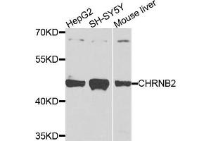 Western blot analysis of extracts of various cells, using CHRNB2 antibody. (CHRNB2 Antikörper)