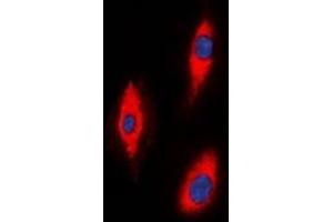Immunofluorescent analysis of ZNRF2 staining in A549 cells. (ZNRF2 Antikörper  (C-Term))
