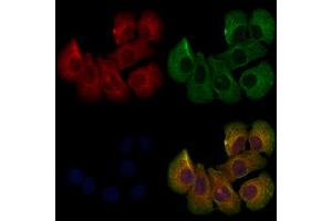 ABIN6261245 and ABIN6273225 staining Hela cells by IF/ICC. (DCTN6 Antikörper  (Internal Region))
